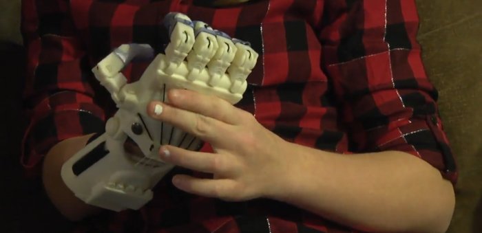 La impresión 3D permite fabricar prótesis de dedos para una niña