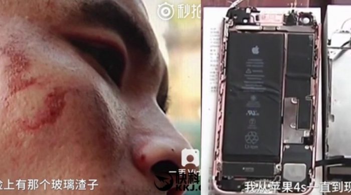 Un iPhone 7 estalla en la cara de su dueño mientras grababa un vídeo